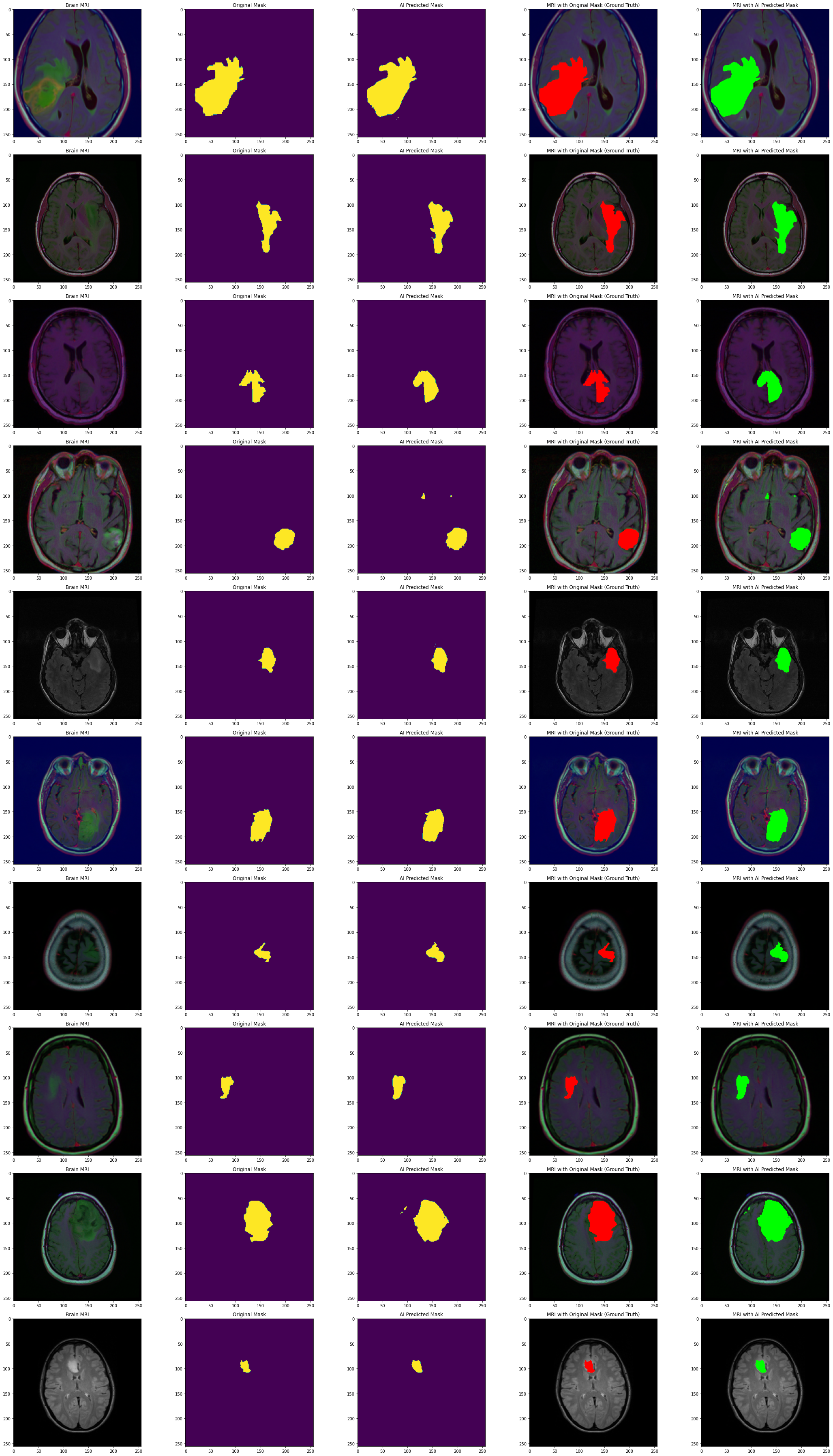 GitHub - LaloGarces/Brain-Tumors-Detection-DeepLearning: Applying AI ...